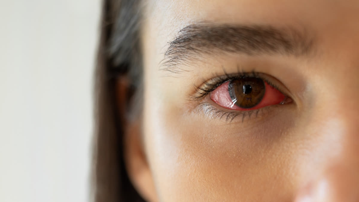 Eye